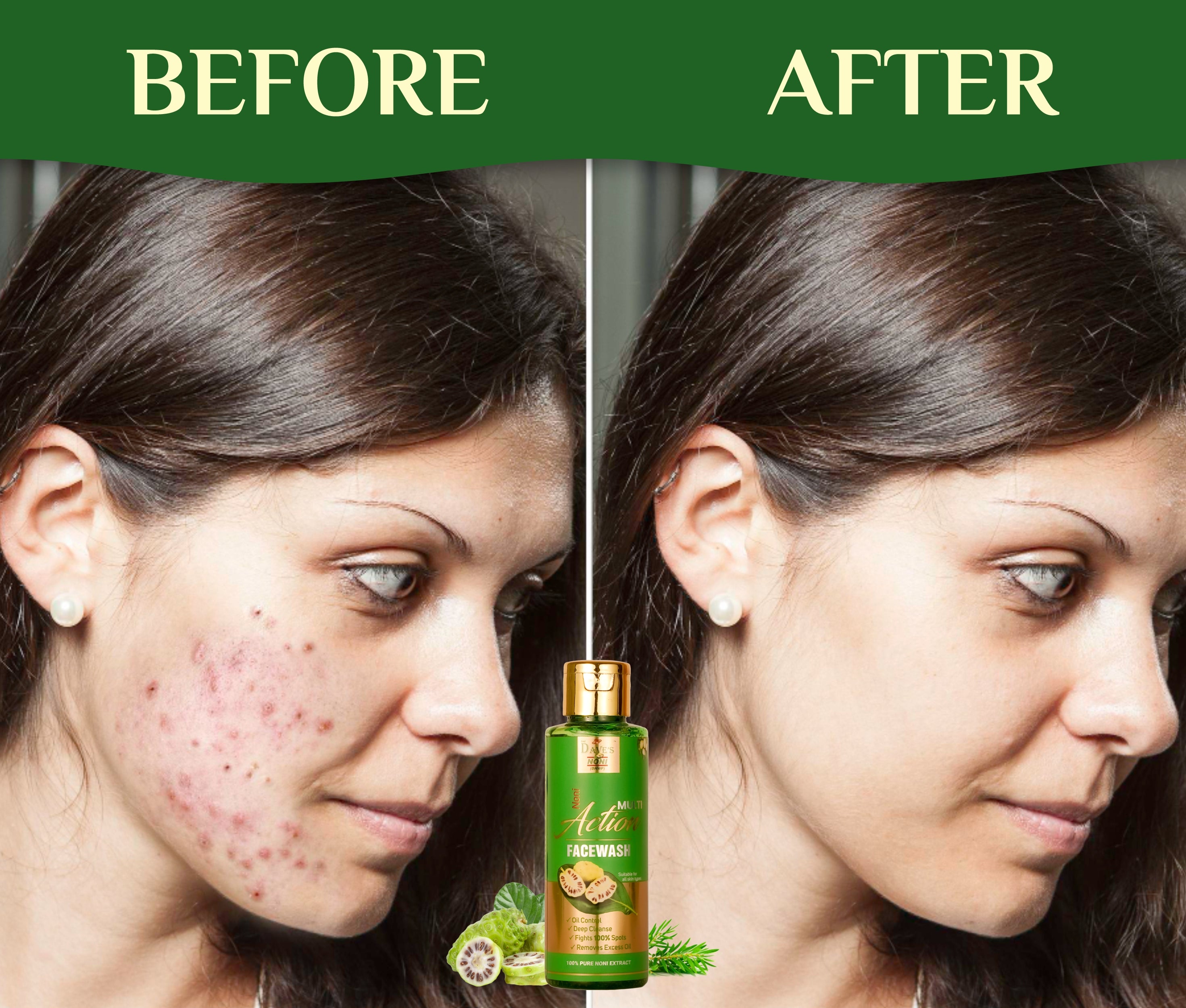 Noni Multi Action Face Wash | Best for Dark Spot Reduction